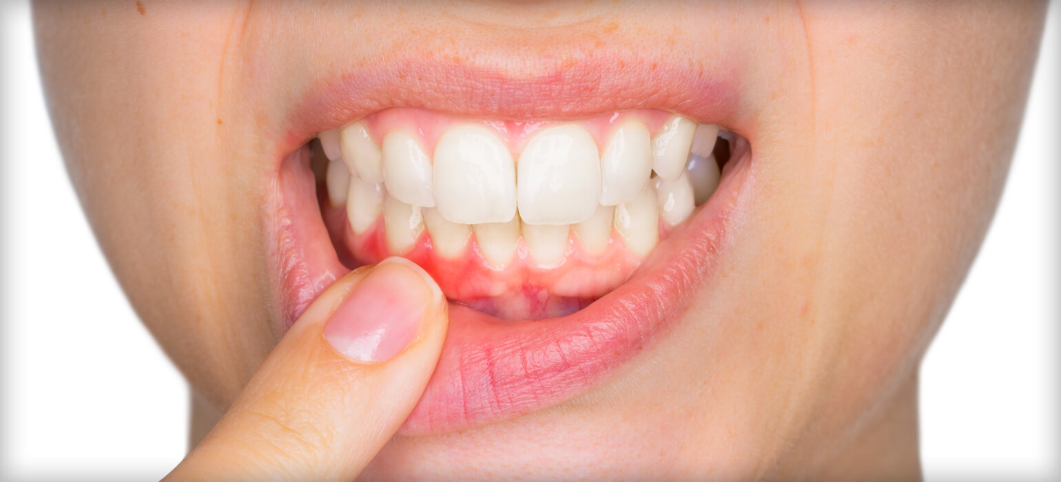 ourservices_gumdisease